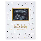 Alternate image 0 for Pearhead&reg; &quot;Hello Baby&quot; Sonogram Baby Memory Book, Black and Gold Polka Dots