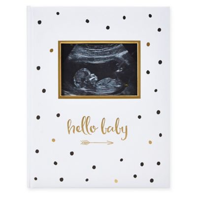Pearhead&reg; &quot;Hello Baby&quot; Sonogram Baby Memory Book, Black and Gold Polka Dots