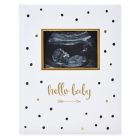 Alternate image 0 for Pearhead&reg; "Hello Baby" Sonogram Baby Memory Book, Black and Gold Polka Dots