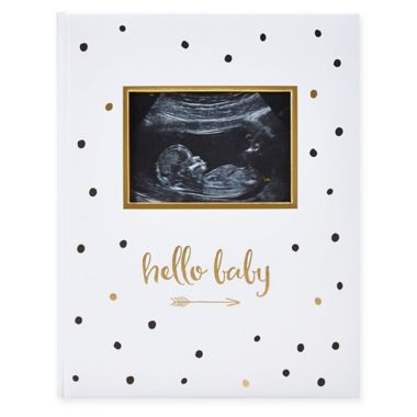 Pearhead&reg; "Hello Baby" Sonogram Baby Memory Book, Black and Gold Polka Dots. View a larger version of this product image.