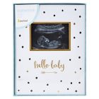 Alternate image 4 for Pearhead&reg; "Hello Baby" Sonogram Baby Memory Book, Black and Gold Polka Dots