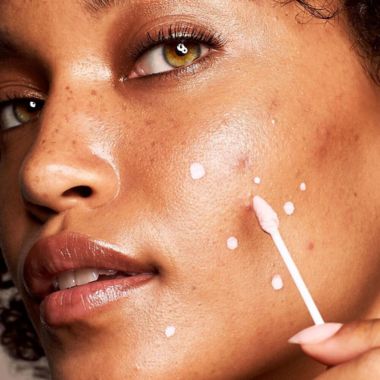 Clixit 1 oz.  Acne Drying Lotion. View a larger version of this product image.