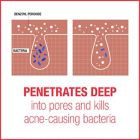 Alternate image 6 for Neutrogena&reg; 2 oz. Stubborn Acne AM Treatment