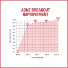 Alternate image 7 for Neutrogena&reg; 2 oz. Stubborn Acne AM Treatment