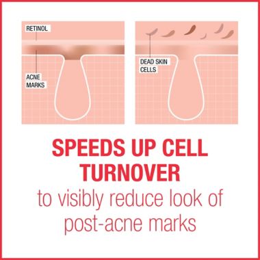 Neutrogena&reg; 1 fl. oz. Stubborn Marks PM Treatment. View a larger version of this product image.