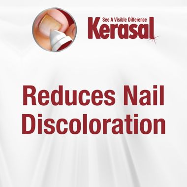 Kerasal&reg; .33 oz. Fungal Nail Renewal Treatment. View a larger version of this product image.
