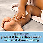 Alternate image 9 for AVEENO&reg; 5 oz. Baby Eczema Therapy Moisturizing Cream