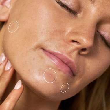 Rael Beauty 52-Count Miracle Patch Overnight Spot Cover. View a larger version of this product image.