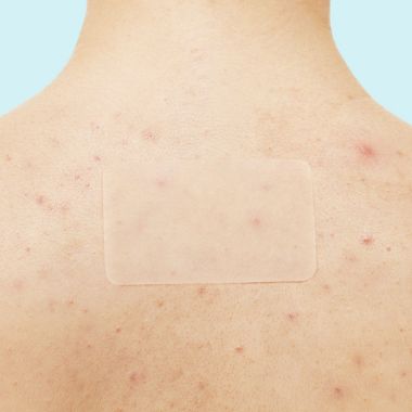 Rael Beauty Miracle Patch XL Spot Control Cover. View a larger version of this product image.