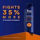 Alternate image 3 for Head &amp; Shoulders&reg; 13.5 fl. oz. Clinical Dry Scalp Rescue Shampoo