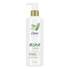 Alternate image 0 for Dove Body Love 17.5 fl. oz. Acne Clear Body Cleanser