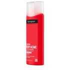 Alternate image 3 for Neutrogena&reg; 8.5 fl. oz. Stubborn Body Acne Cleanser &amp; Exfoliator