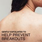 Alternate image 8 for Neutrogena&reg; 8.5 fl. oz. Stubborn Body Acne Cleanser &amp; Exfoliator