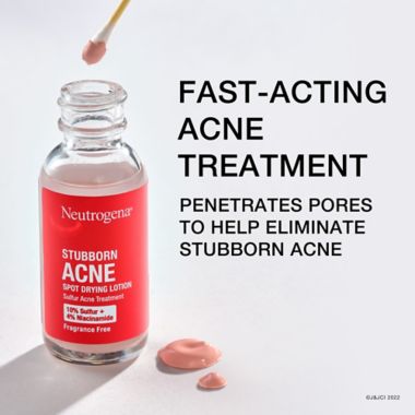 Neutrogena&reg; 1 fl. oz. Stubborn Acne Drying Lotion. View a larger version of this product image.