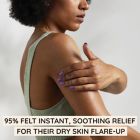 Alternate image 6 for Aveeno&reg; 5 fl. oz. Eczema Therapy Rescue Relief Gel Cream