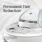 Alternate image 4 for Remington&reg; iLIGHT Ultra Face and Body IPL Hair Removal System