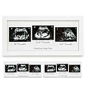 KeaBabies Sonogram Picture Frame - Trio Ultrasound Picture Frames For New Mom, Sonogram Photo Frame (Alpine White)