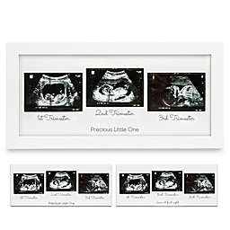 KeaBabies Sonogram Picture Frame - Trio Ultrasound Picture Frames For New Mom, Sonogram Photo Frame (Alpine White)