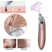 Glam Hobby Electric Facial Skin Care Pore Blackhead Cleaner, Rose Gold