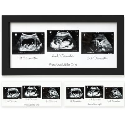 KeaBabies Sonogram Picture Frame - Trio Ultrasound Picture Frames For New Mom, Sonogram Photo Frame (Onyx Black)