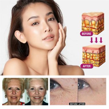 Hailicare Collagen Anti-Aging Facial Skin Set. View a larger version of this product image.